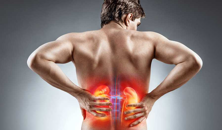 back pain 