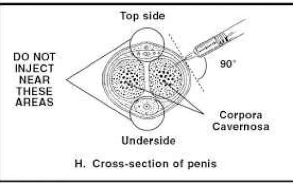 Penis Injection Risks (1) ကျားအင်္ဂါဆေးထိုးတဲ့ အန္တရာယ်တွေ (၁)