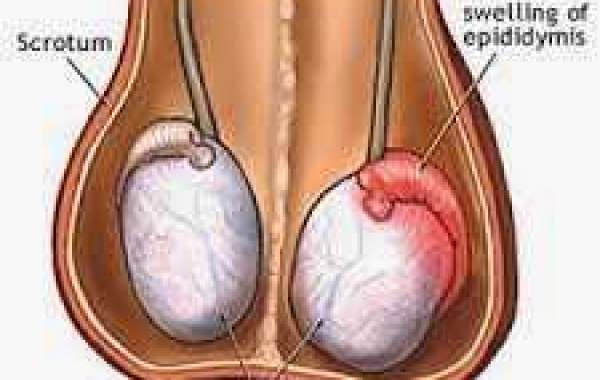 Epididymitis and Orchitis ကျား အစေ့-အကြောရောင်ခြင်း