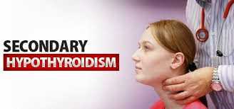 Hypothyroidism