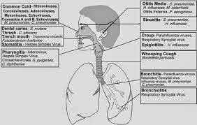 Respiratory tract infections