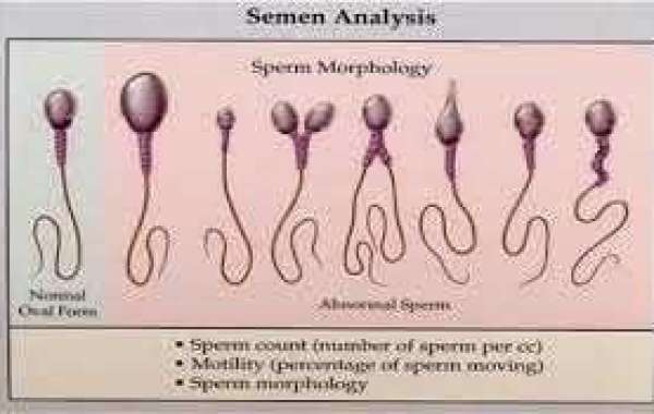 Semen question သုက်ရည် မေးခွန်း