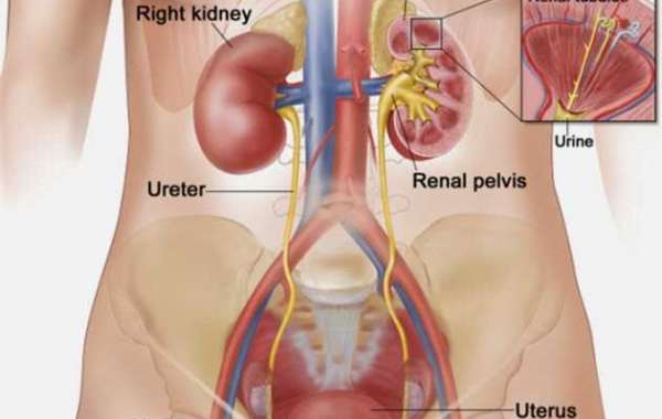 Urinary Tract Infection (2) ဆီးလမ်းကြောင်း ပိုးဝင်ခြင်း (၂)
