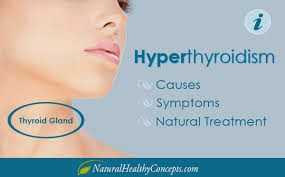 Hyperthyroidism