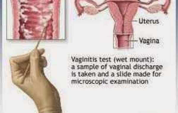 Vulvovaginitis အမျိုးသမီးအင်္ဂါ ရောင်ခြင်း