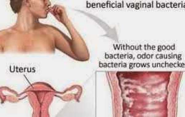 Bacterial vaginosis (ဗဂျိုင်းနား) (ဗက်တီးရီးယား) ဝင်ခြင်း