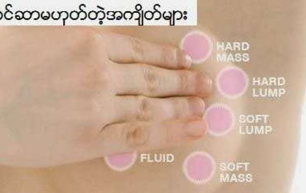 Breast Benign Lumps ကင်ဆာမဟုတ်တဲ့ ရင်သားအကျိတ်များ