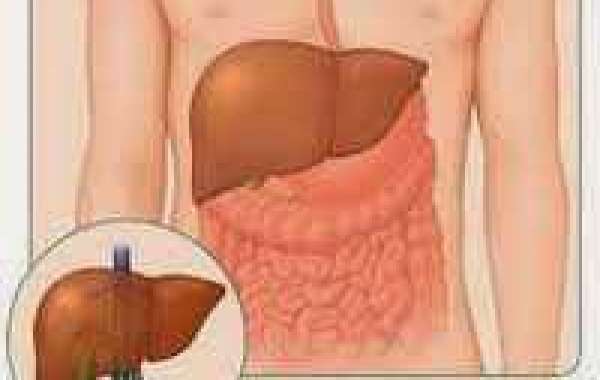 Hepatitis C Viral Load (စီ) ပိုး (ဗိုင်ရယ်လ်-လုဒ်)