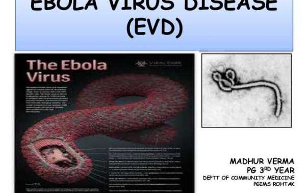 Ebola virus disease (အီဗိုလာ) ဗိုင်းရပ်စ်ရောဂါ