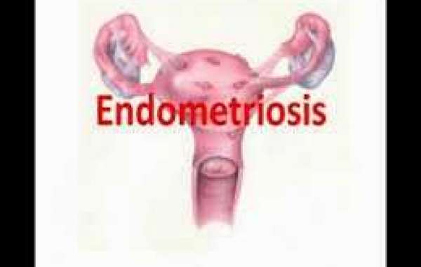 Endometriosis (2) သားအိမ်ရောဂါ (၂)