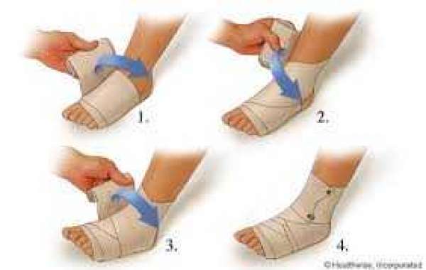 Ankle sprain ခြေခြင်းဝတ်ခေါက်လဲခြင်း