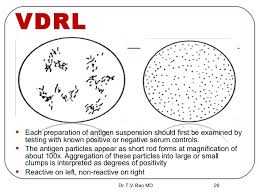 VDRL နဲ့ TPHA
