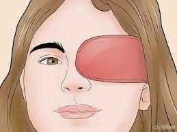 Astigmatism and Amblyopia