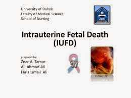 Pregnancy and Intrauterine Death (IUD)