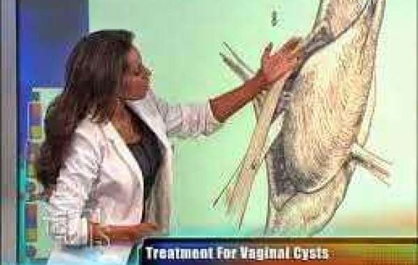 Vaginal Cysts Polyps Warts ဗဂျိုင်းနားမှာ အပိုအဆာတွေ ဖြစ်တာ