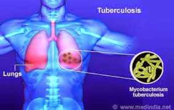 MDR-TB ဆေးယဉ်တဲ့ တီဘီ