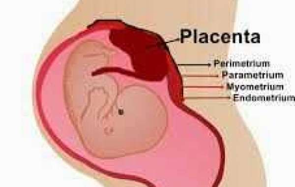 Placenta accreta အချင်းပုံမှန်မဟုတ်ခြင်း