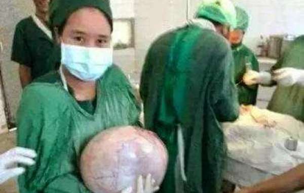 Ovarian Cyst ကိုယ်ဝန်မဟုတ်တဲ့ ဗိုက်ထဲကအလုံး