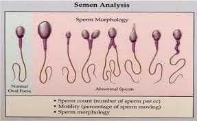 Semen question