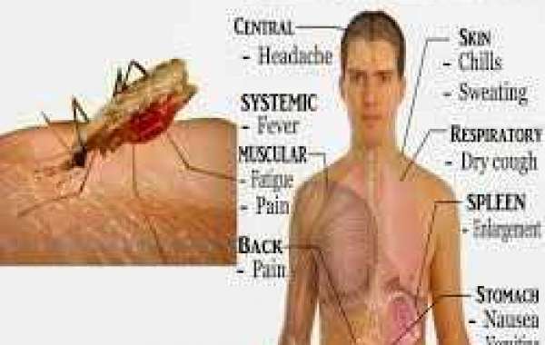 Malaria ငှက်ဖျားရောဂါ