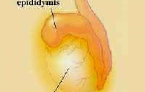 Epididymitis and Orchitis ကျား အစေ့-အကြောရောင်ခြင်း