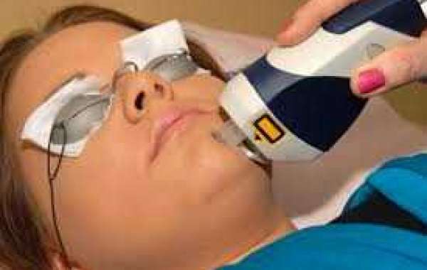Acne Laser treatment ဝက်ခြံကို လေဆာ နဲ့ ကုသခြင်း