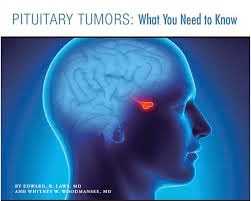 Pituitary gland tumors