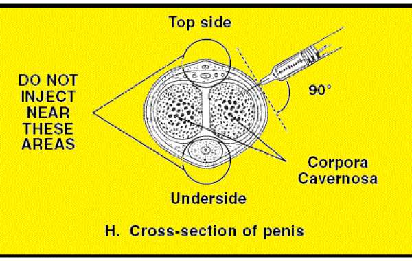 Penis Injection Risks ကျားအင်္ဂါဆေးထိုးတဲ့ အန္တရာယ်တွေ