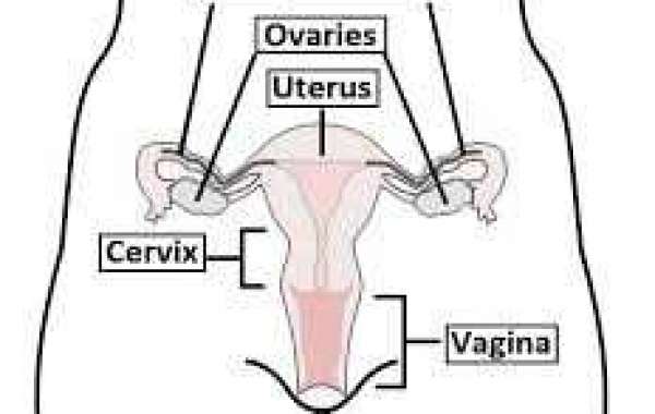 Ovarian dermoid cyst ဒါးမွိုက်ဆစ်