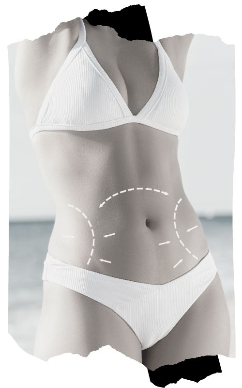 Vaser Liposuction Nedir? | Yağ Aldırma İşlemi - Doç. Dr. Erdem Güven