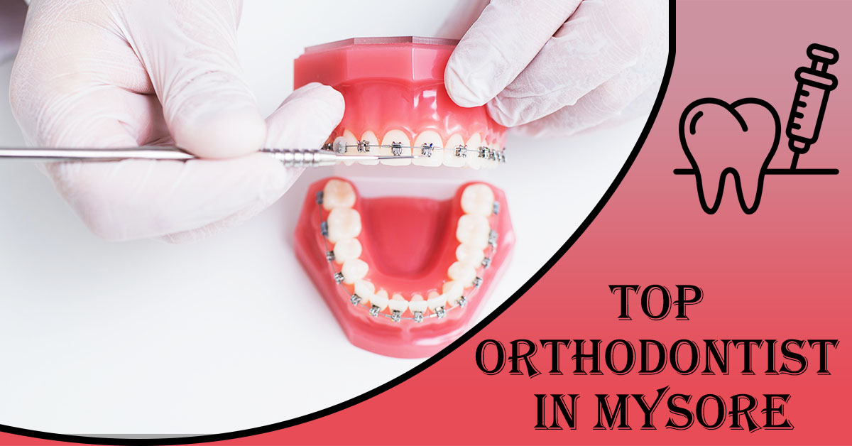 Best Orthodontist in Mysore | Orthodontist in Mysore