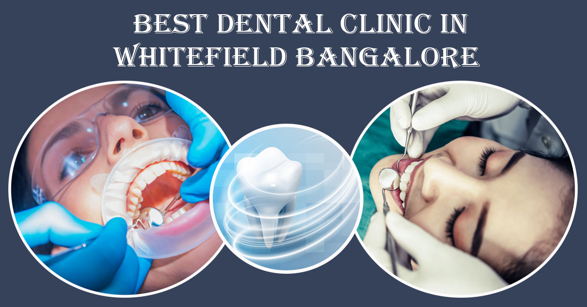 Best Dentist in Whitefield Bangalore | Famous & Top Dental