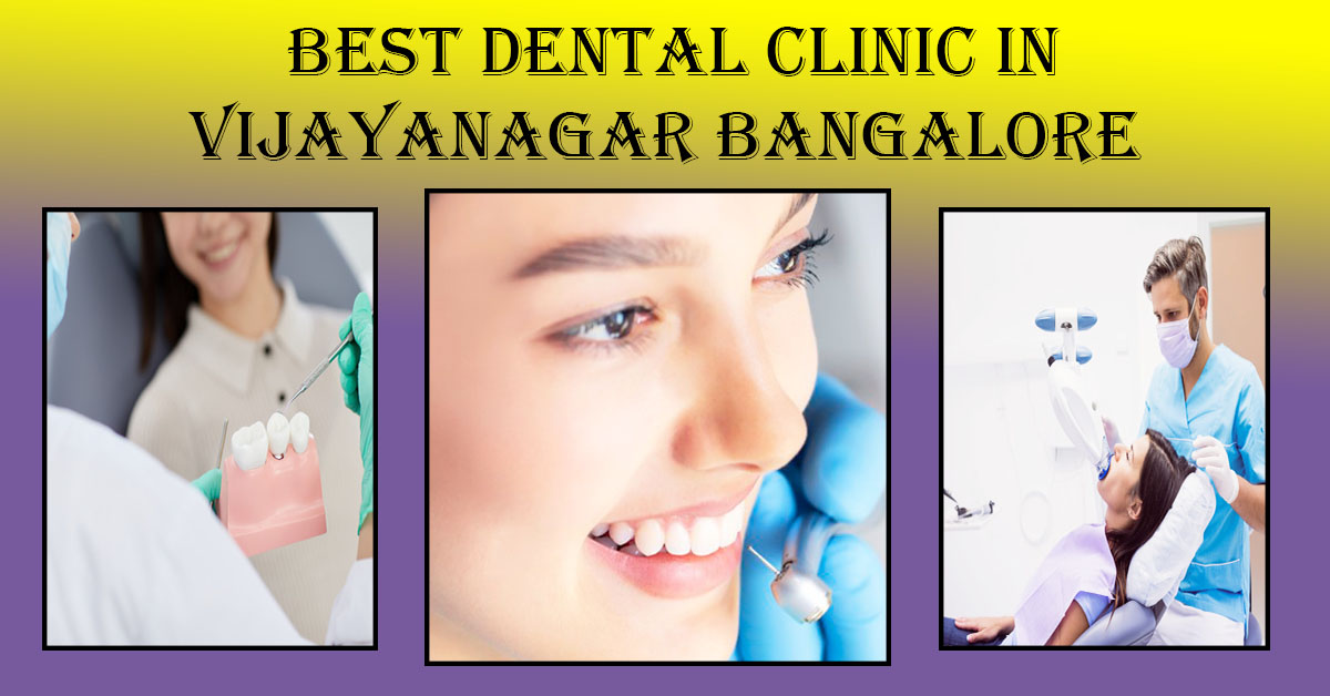 Best Dentist in Vijayanagar Bangalore | Famous & Top Dentist